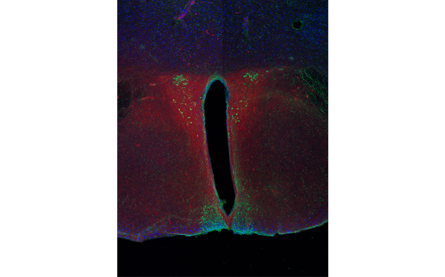 Stained neurons in the region of the brain that controls circadian rhythm; image provided by the author.